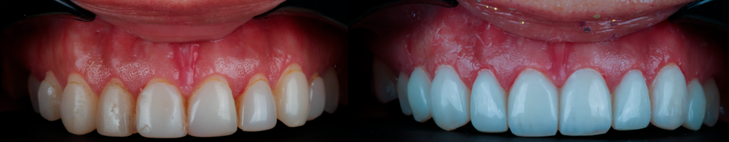 Atención odontológica personalizada en ProStetic, dentista en Quito
