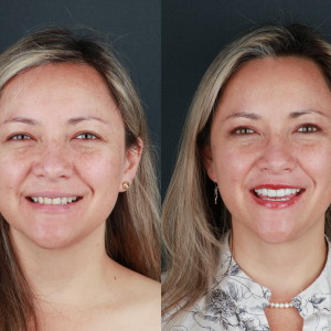 Eli antes despues pagina Web